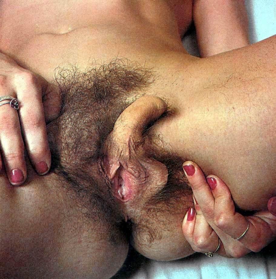 King o. A. reccomend nude black big clitoris