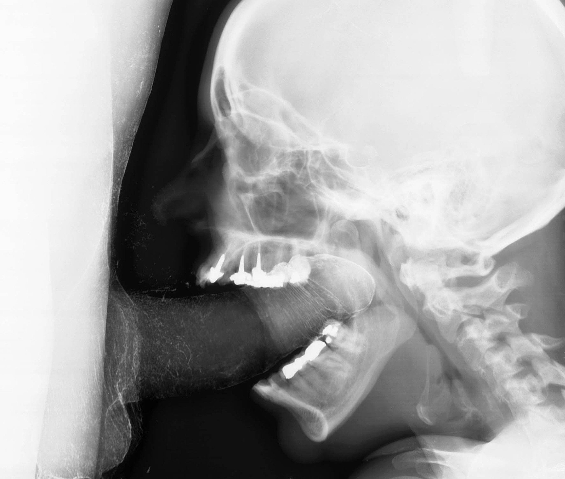 X ray of blowjob - 🧡 After Hours at the Radiologists - Picture eBaum'...