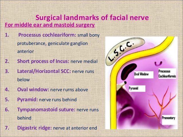 Markers for facial nerve