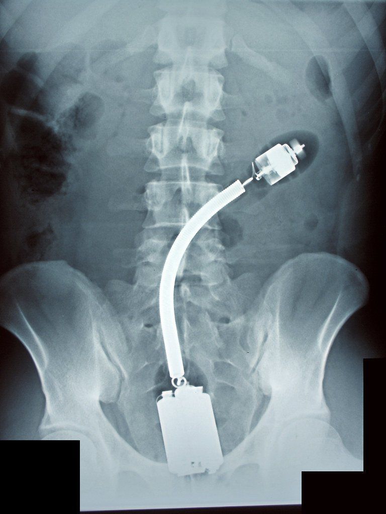 Kevlar reccomend X-ray of dildo