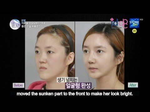Radar reccomend Twins facial korean horror