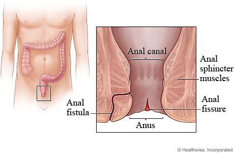 best of After Sore movement anus bowel