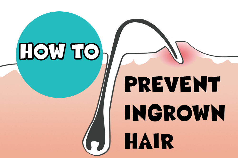 Avoid ingrown hairs bikini