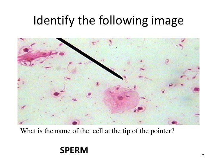 best of Smear histology Sperm
