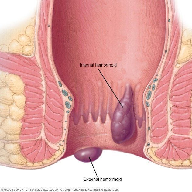 Protrusion near anus