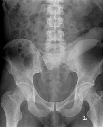 Bulldog reccomend X-ray of dildo