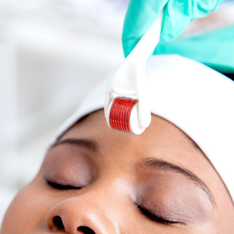 Hot B. reccomend Microfine needle facial treatment