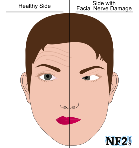 Facial nerve breathing