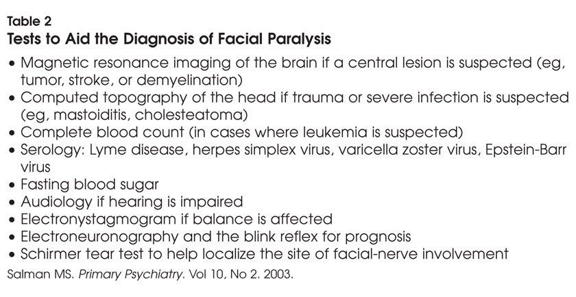 best of Facial nerve palsy Recurrent