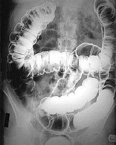 X-ray of dildo