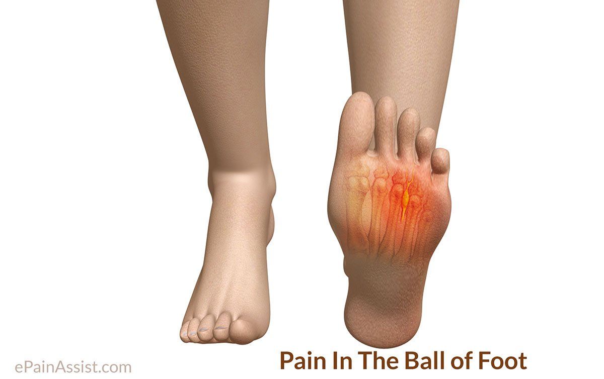 Foot injury bottom ball sports