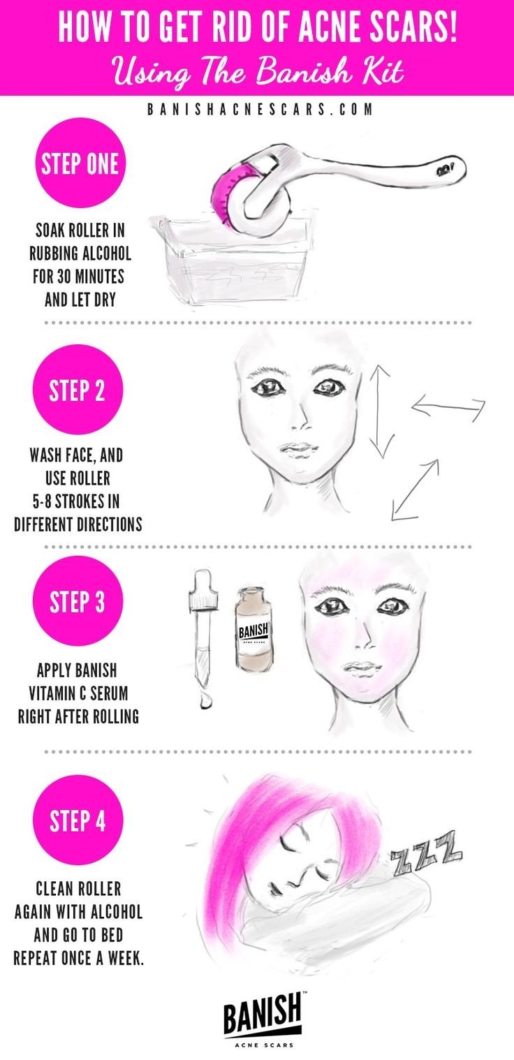 Acne facial care skin tip