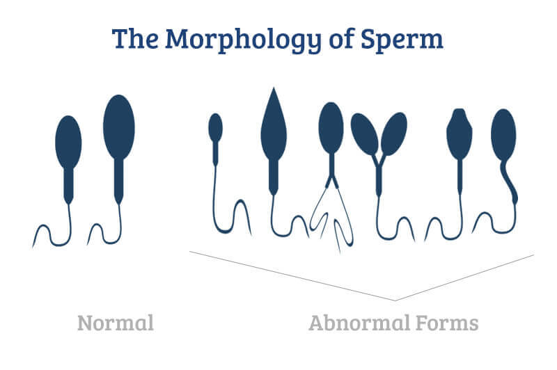 Can you ever run out of sperm