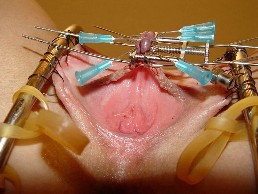 best of Pain Clitoris needle
