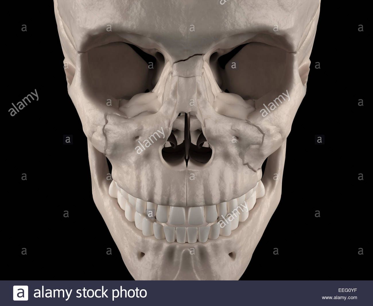 Complex facial fractures