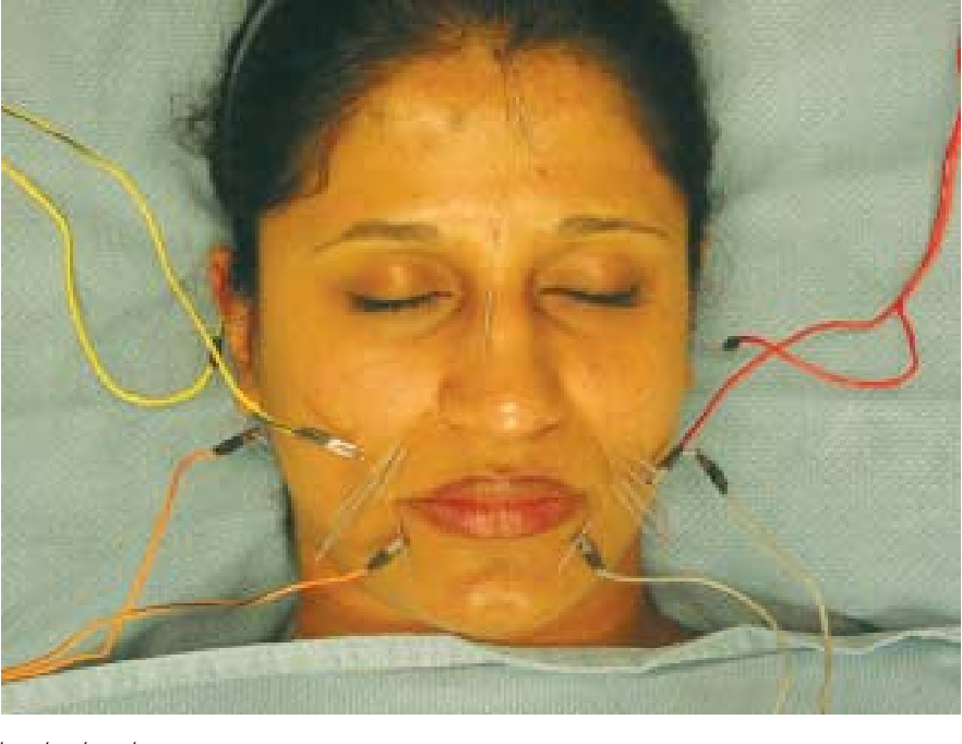 Facial rejuvenation acupuncture boulder