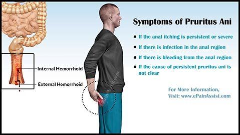 best of Remedies anal pain Home irritation
