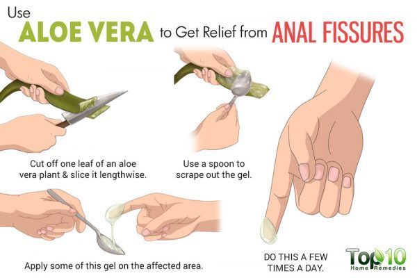 Home remedies for anal pain