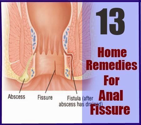Peacock reccomend Home remedies for anal pain