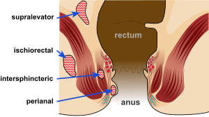 Insertion into anus hurt