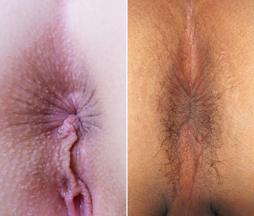 Mamsell reccomend Male anal hole pics