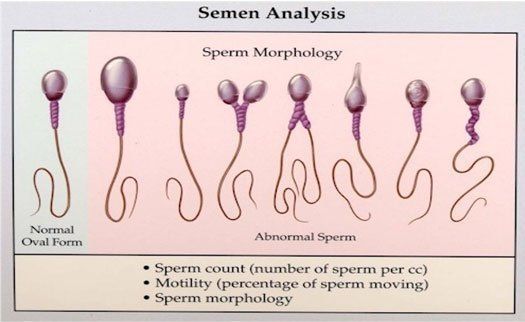 Male sperm color