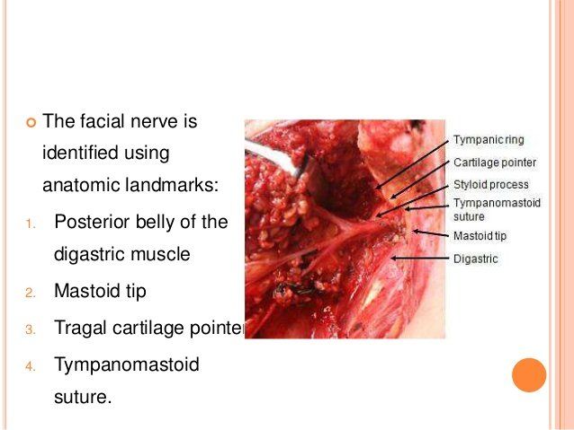 best of Nerve Markers for facial