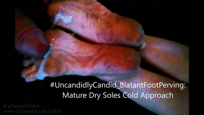 Brunette complaint about calloused soles